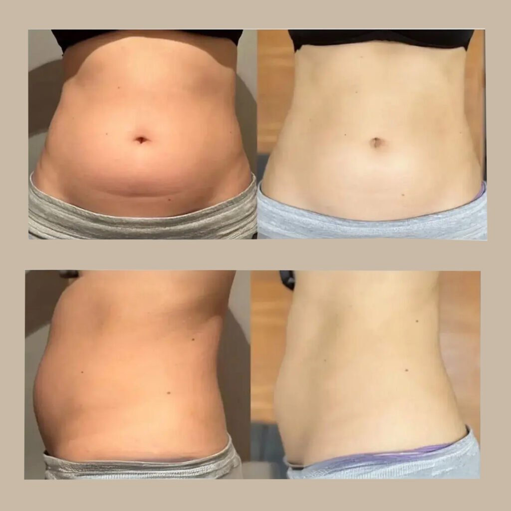 fat6 dissolving lemon bottle